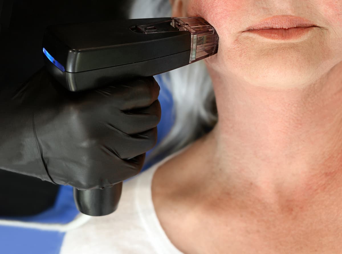 Morpheus8 Treatment: What to Expect | Lyla Clinic